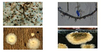 霉菌對人體的危害，你都知道嗎？