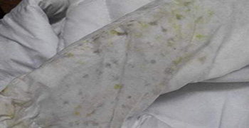 冬季服裝發霉，如何去霉防霉？