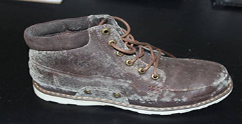 皮革霉菌種類你知道多少？