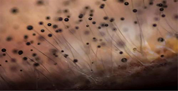 霉博士帶你正確認識微生物！