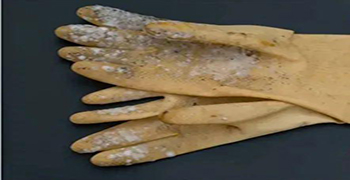 微生物災(zāi)害所涉及的領(lǐng)域有多少（三）？