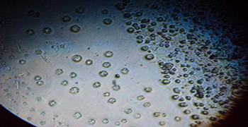 微生物活動與衛生清潔的關系!